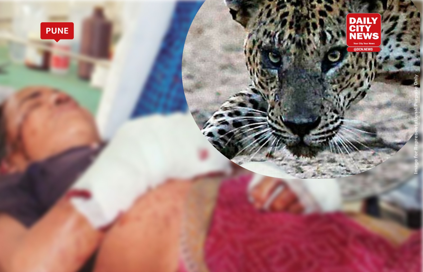 Woman dies after being attacked by leopard