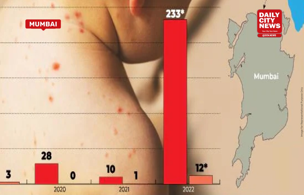 Outbreak! 13 new measles cases, 1 death in Mumbai